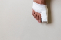 Caring for a Broken Toe and Preventing Complications