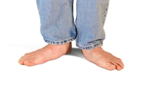 Treating Pain From Flat Feet