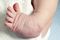 Checking Newborn Feet and What Doctors Look For